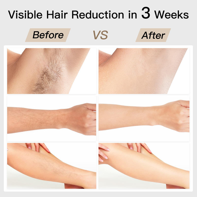 Laser Hair Removal, BoSidin IPL Hair Removal with Painless Ice-Cooling, 2-in-1 Face SR Rejuvenation, 6+1 Modes, 6 Levels Hair Removal for Women Permanent, Laser Hair Removal Kit with Shaver, Goggles